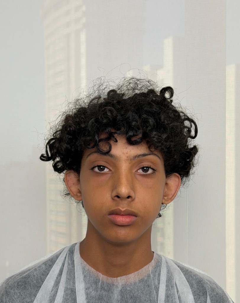 Caso 2 — antes
